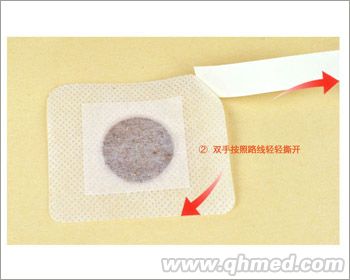 咳喘贴 