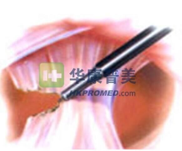 点击放大 英国佳乐PK针形电切刀3400PK 佳乐 英国佳乐PK针形电切刀3400PK 佳乐