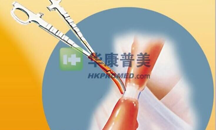 点击放大 英国佳乐PK凝血钳3105PK 英国佳乐PK凝血钳3105PK