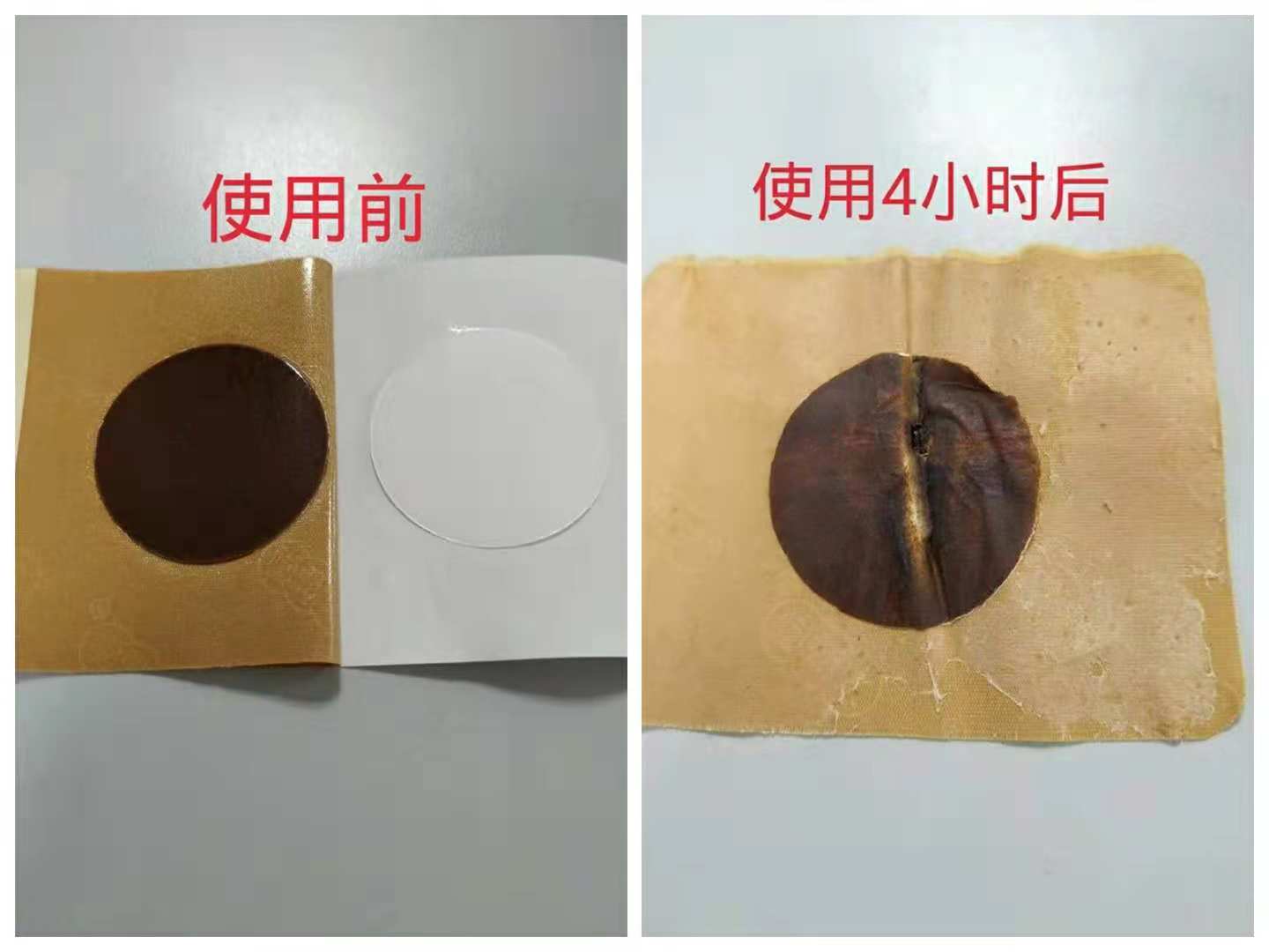 点击放大 新型新款足贴 上病取下,百病治足